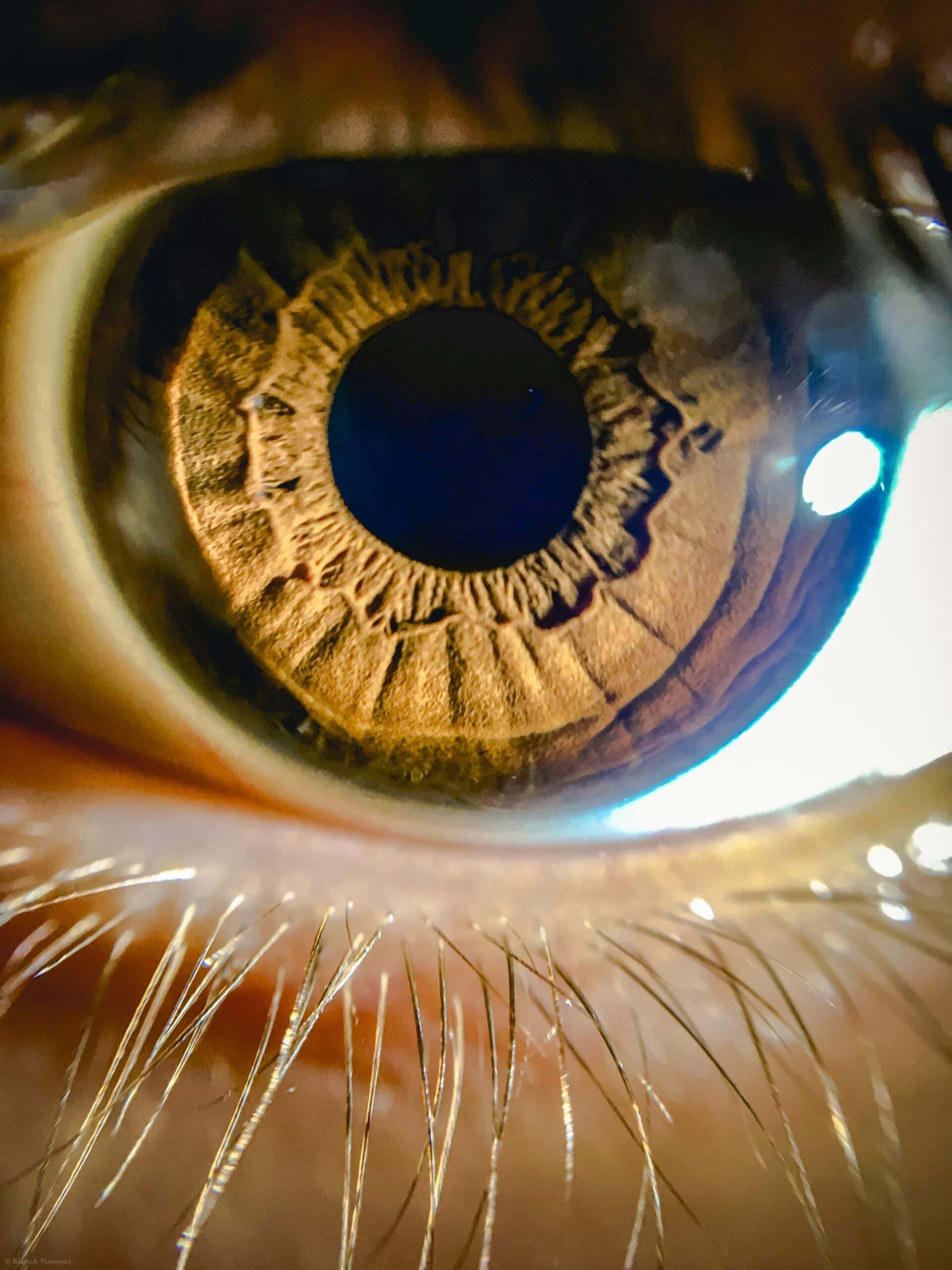 Primo piano iride occhio umano - glaucoma oftalmologia